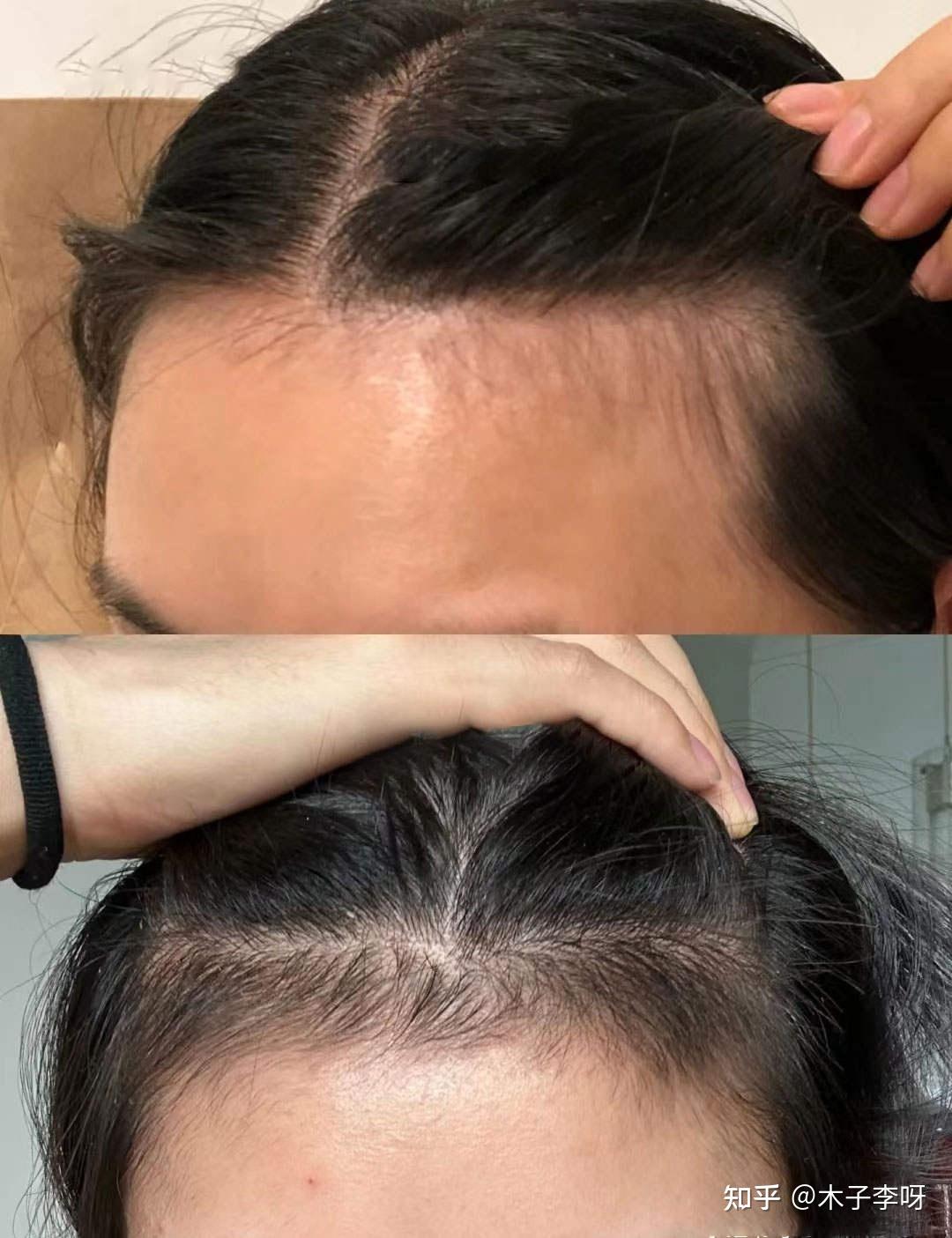仅为人类头发直径的二十万分之一 中科院创造出新二维金属仅为人类头发直径的二十万分之一 中科院创造出新二维金属
